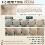 Pigmentation Cream Flyer 1 without price-01